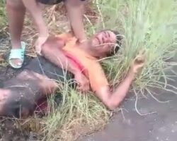 Drunk motorcyclist suffered severe burns in crash