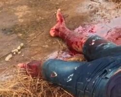 Dude lost his foot in motorcycle crash