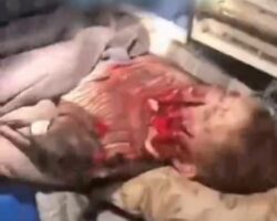 Electronic cigarette exploded in his face