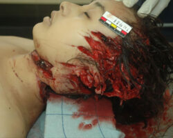 Female victim of machete murder in China