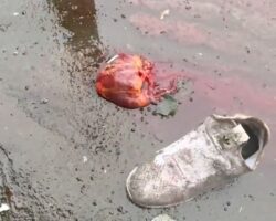 Girl’s heart beating outside her body after car crash