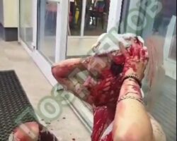 Guy in Russia scalped by orthodox Muslim over his hair color
