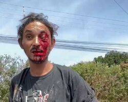 Homeless man lost eye in knife attack