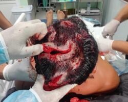 Indigenous community chief in Amazon mauled by jaguar
