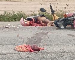 Intestines of motorcyclist flew out in accident