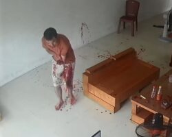 Lover gets arm chopped off by machete-wielding husband