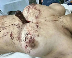 MIX: Random dead women #84