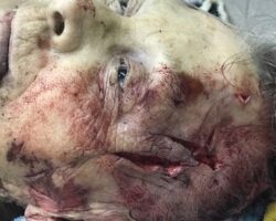 Mentally ill woman cut herself with knife and jumped to her death