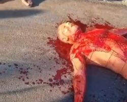 Motorcyclist got slashed by fallen kite-flying wire