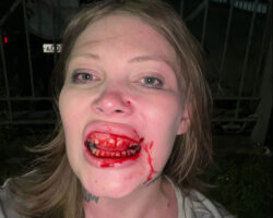 Russian influencer attacked during live stream