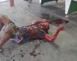 Stabbed by his wife with kitchen knife