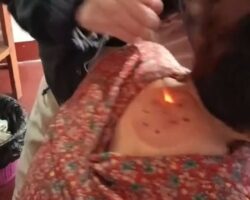 Strange practice of Chinese alternative medicine