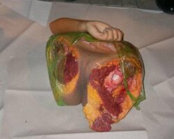 Terrifying discovery of dismembered Chinese woman