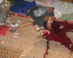 Thai man blew his brains out of his head with shotgun