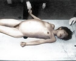 Young woman died from constipation