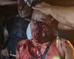 Bloody aftermath of mototaxi collision with car