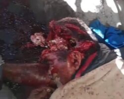 Brazilian ended up with bullethole in his head