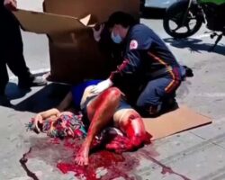 Cyclist suffered serious leg injury in accident