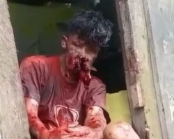 Dude blew off part of his face while carelessly handling gun