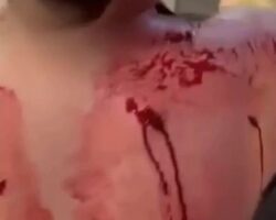 Dude stabbed by crazy Chinese woman during mass brawl