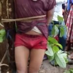 Guy hacked off his own mother’s forearm with machete