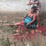 Guy hacked off his own mother’s forearm with machete