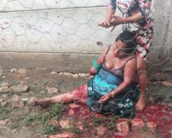 Guy hacked off his own mother’s forearm with machete