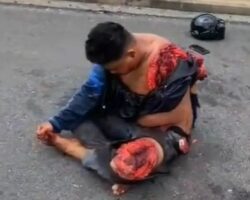 Malaysian motorcyclist lost his entire arm in accident