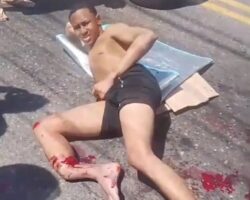 Motorcyclist seriously injured his leg in crash