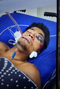 Road rage incident ends in coma