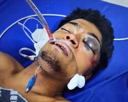 Road rage incident ends in coma
