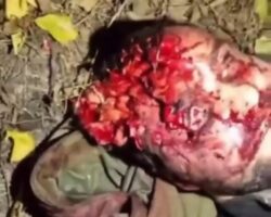 Ukrainian soldier with open head injury