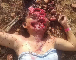Woman found dead with large hole in her head
