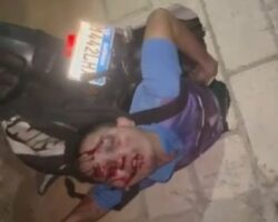 Young man dying after crashing his motorcycle into wall