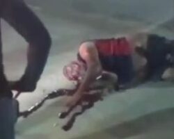 Biker, in shock after accident, trying to fix his broken arm