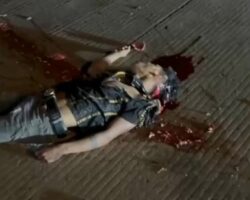 Biker shattered in terrible accident