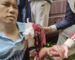 Bus passenger lost part of his arm in collision with truck