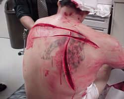 Consequences of brutal knife fight