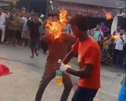 Fire breather suffered severe facial burns