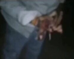 Firecracker rips Indian man’s hand apart