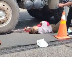 Garbage truck crushed her entire arm