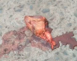 Heart of crushed accident victim still beats on asphalt