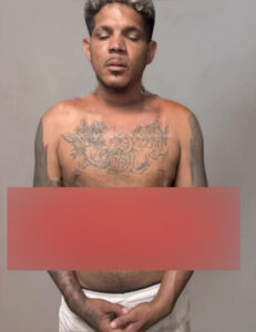 Man bit off his girlfriend’s lower lip