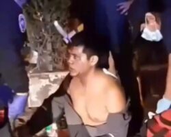 Man got knife stuck in his forehead