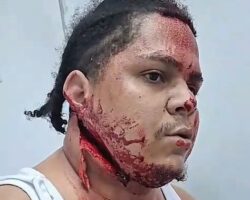 Man slashed in face during fight