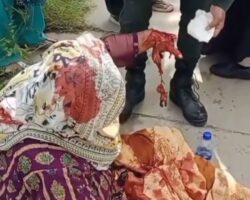 Passing train seriously injured elderly woman’s hand