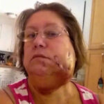 Pitbull bites grandma in face during ice bucket challenge