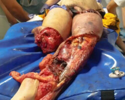 Portuguese man trapped under train suffered serious injuries
