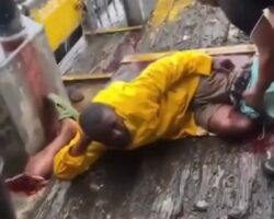 Snapped marine rope tore off fisherman’s leg