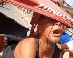 Tuk-tuk driver lost eye in accident